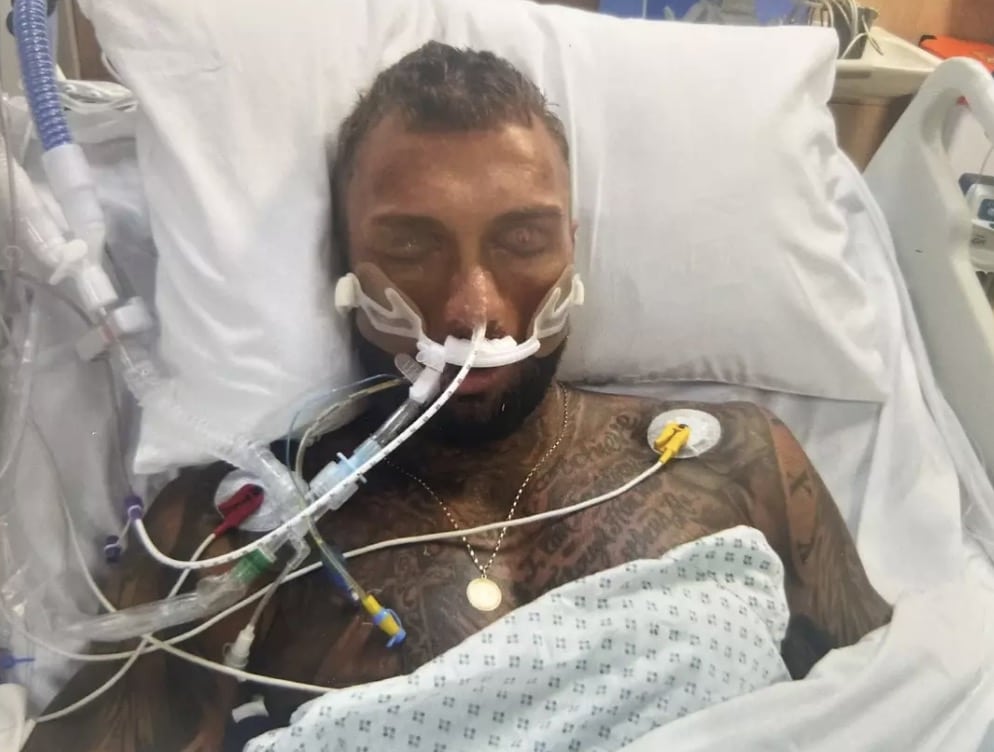 Fisiculturista de 32 anos luta pela vida após vício em remédio comum, sem conhecer seus perigosos efeitos colaterais O fisiculturista gastou mais de £ 35 mil com o vício em drogas (SWNS)