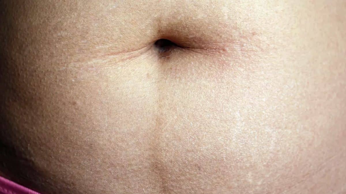 Pessoas chocadas ao descobrir o que aquela linha escura na barriga realmente significa