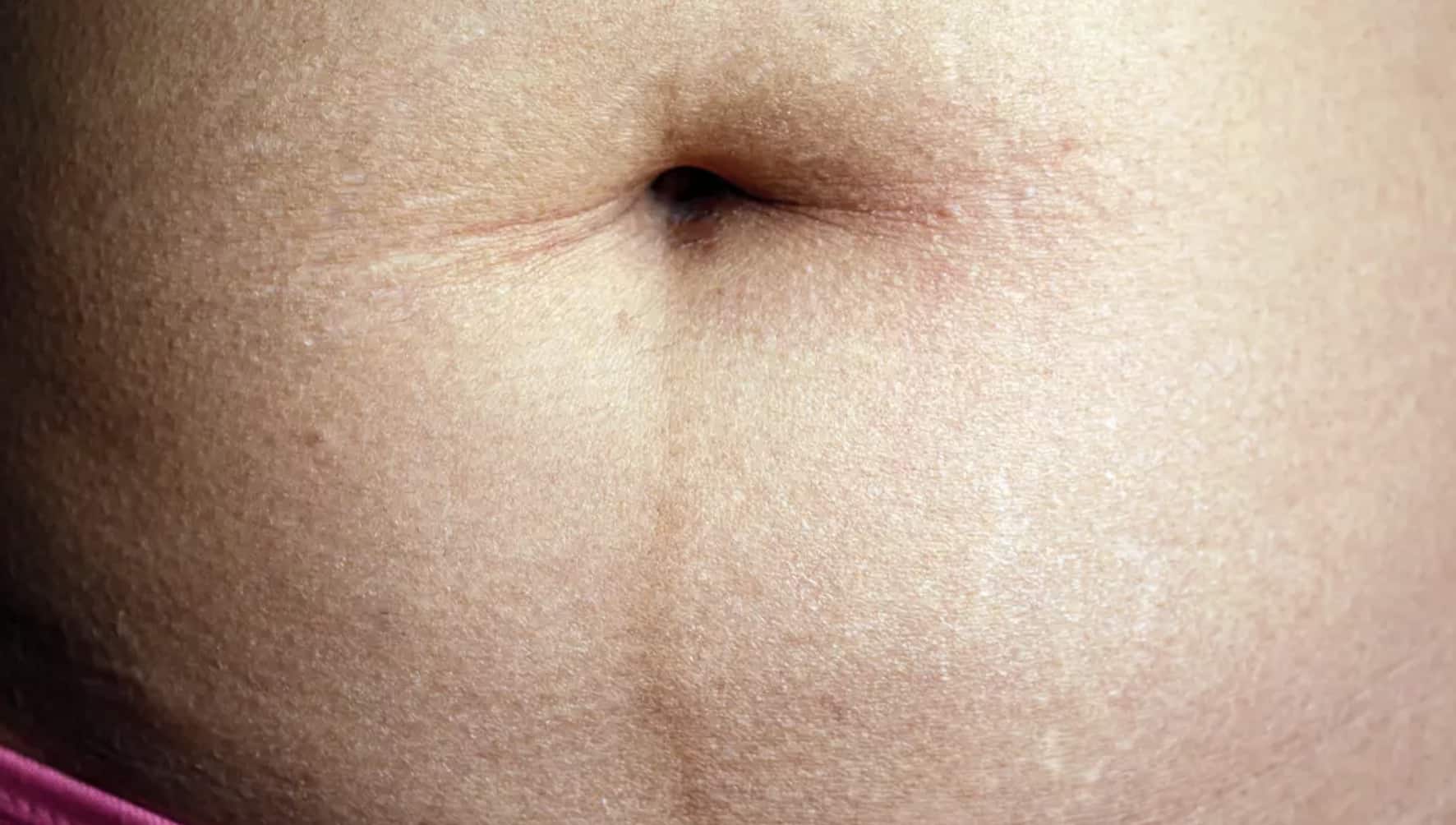 Pessoas chocadas ao descobrir o que aquela linha escura na barriga realmente significa Pessoas chocadas ao descobrir o que aquela linha escura na barriga realmente significa
