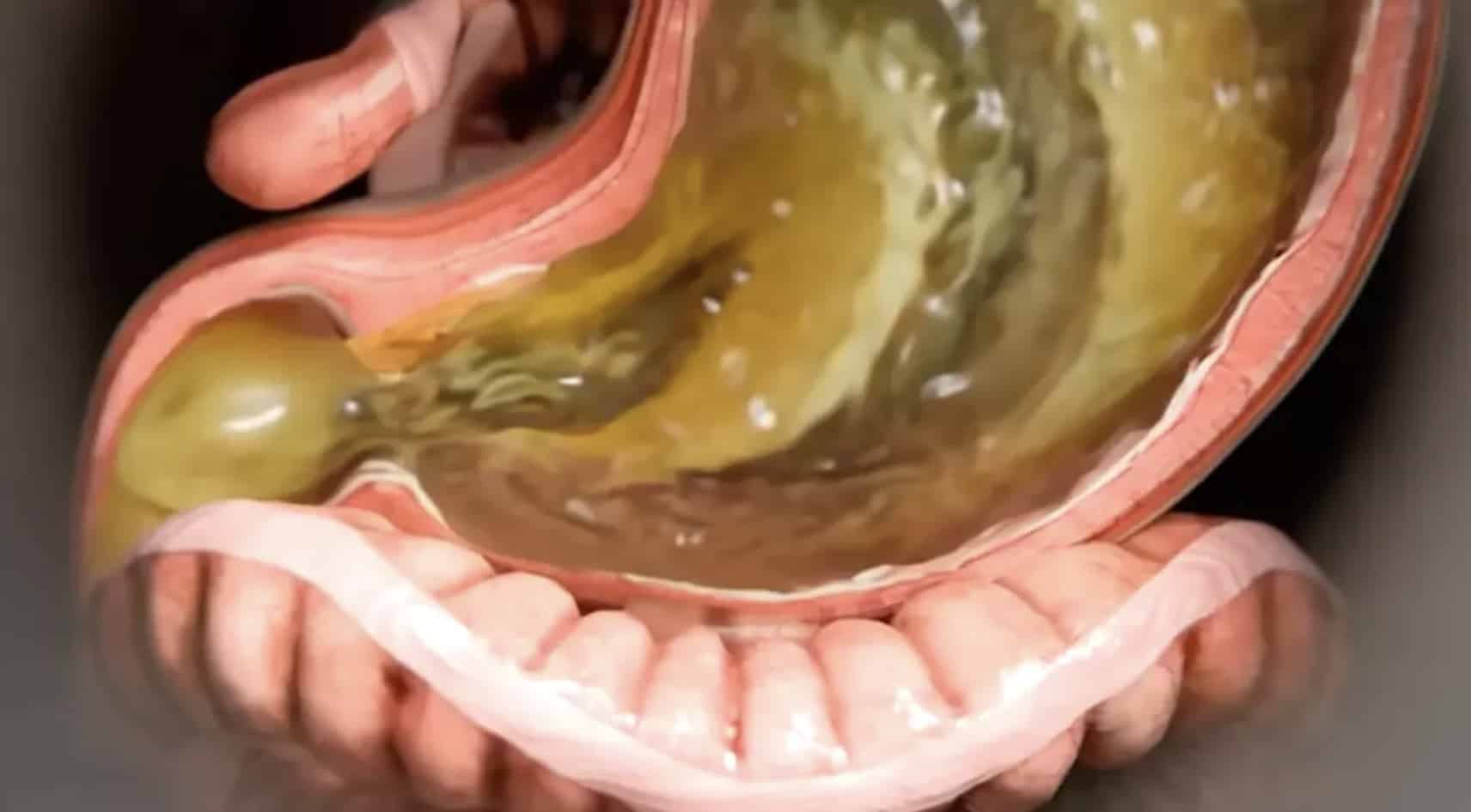 Simulação mostra a realidade do que o Ozempic faz ao seu corpo Simulação mostra a realidade do que o Ozempic faz ao seu corpo