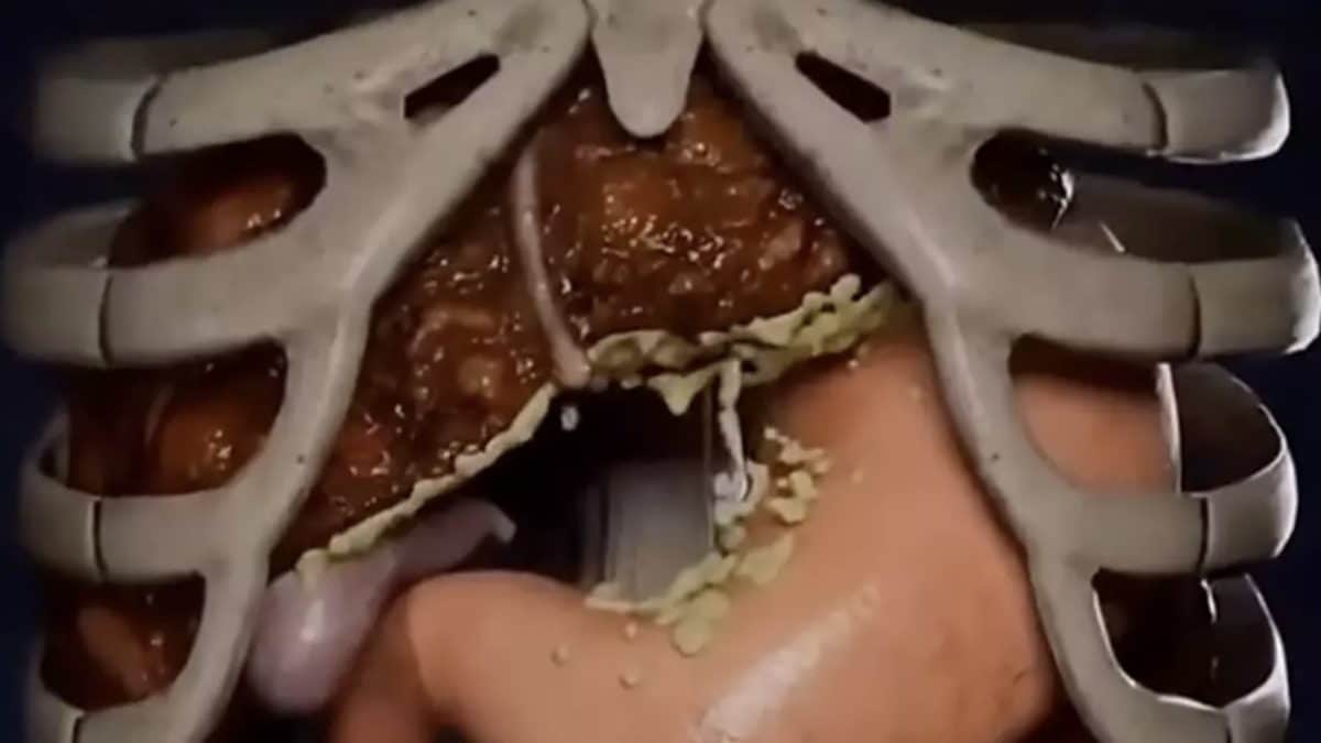 simulação chocante mostra o impacto extremo de ficar 36 horas sem comer