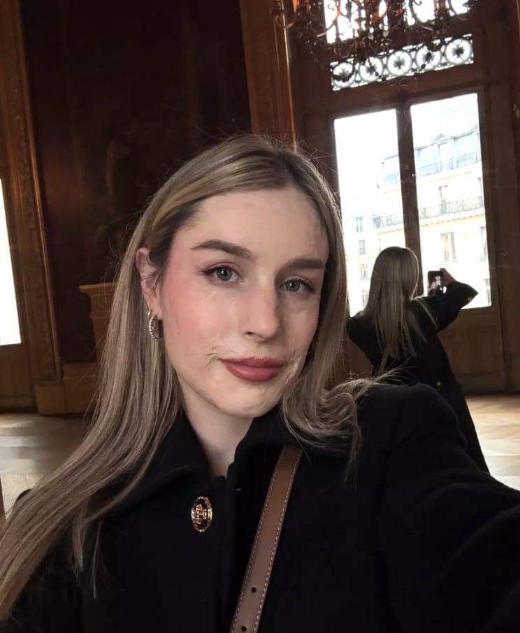 Mulher gravemente queimada em desastre vulcânico que matou 22 pessoas mostra como está 5 anos depois Cinco anos depois, Stephanie agora usa sua plataforma nas redes sociais para defender vítimas de queimaduras, além de atualizar seus seguidores sobre sua jornada de recuperação (Instagram/@stephaniecoral96)