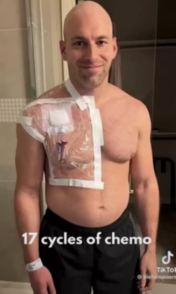 Ele passou por duas grandes cirurgias de 10 horas cada (The Patient Story/YouTube)