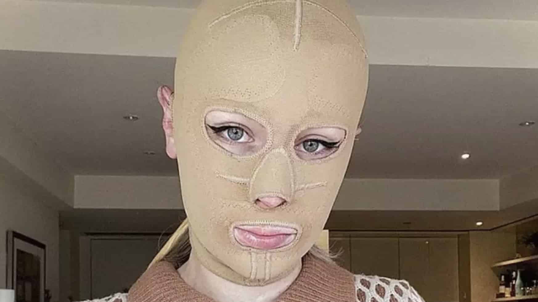 Mulher gravemente queimada em desastre vulcânico que matou 22 pessoas mostra como está 5 anos depois Mulher gravemente queimada em desastre vulcânico que matou 22 pessoas mostra como está 5 anos depois