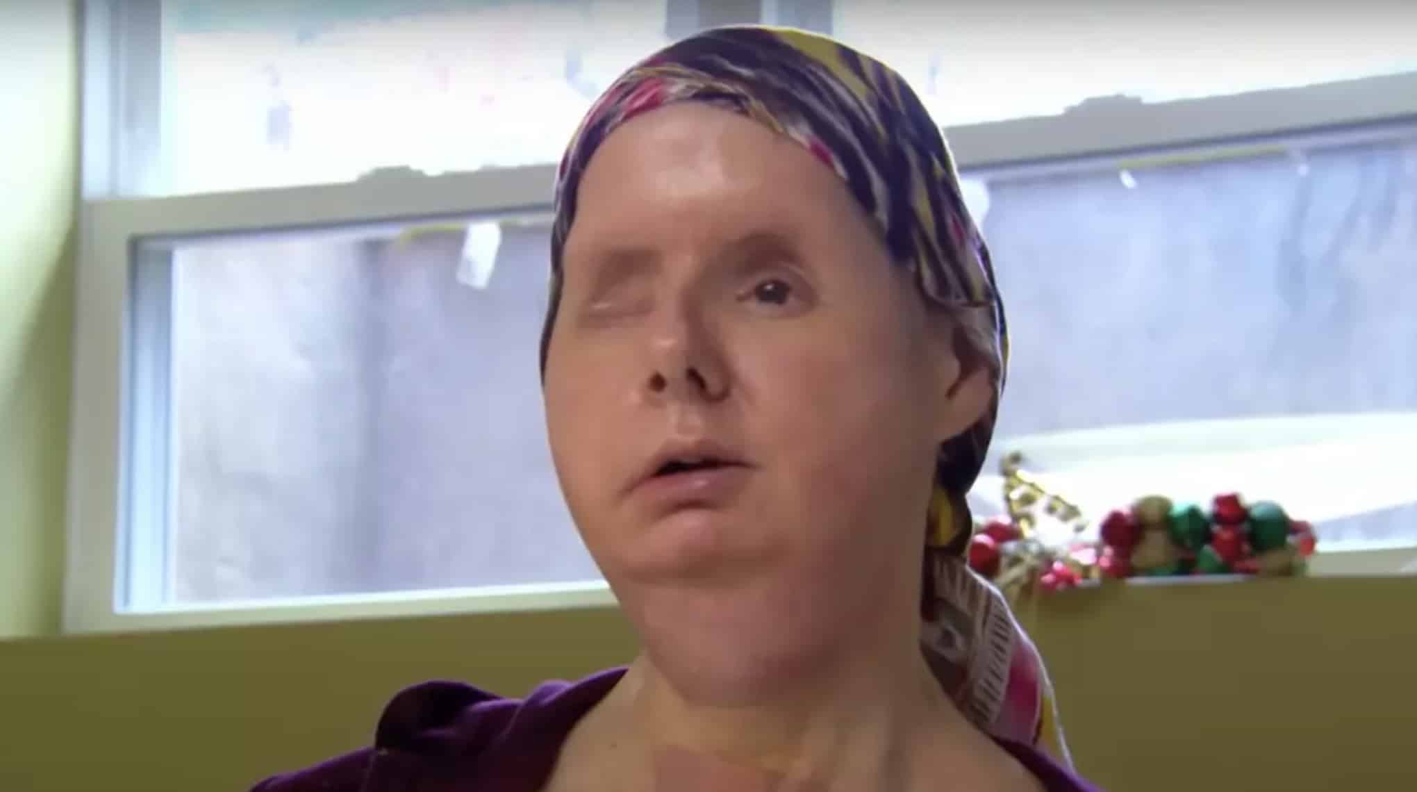 Mulher que teve o rosto arrancado por chimpanzé de estimação de amiga revela o som horrível que ouviu durante o ataque Mulher que teve o rosto arrancado por chimpanzé de estimação de amiga revela o som horrível que ouviu durante o ataque