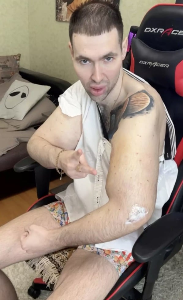 'Popeye russo' que injetou óleo nos bíceps é hospitalizado após causar graves preocupações médicas O influenciador russo revelou que fez "cirurgia para remover os bíceps" (Instagram/@ruki_bazuki_official)