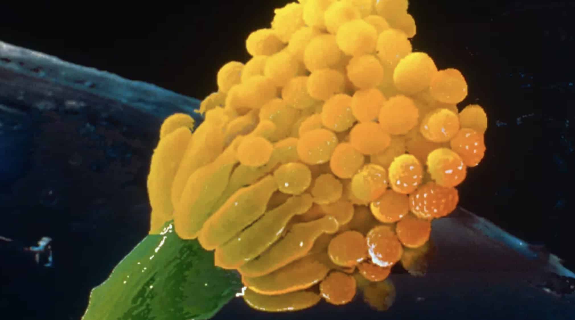 Cientistas emitem alerta sobre fungo mortal que 'devora você de dentro para fora' e que pode afetar milhões fungo