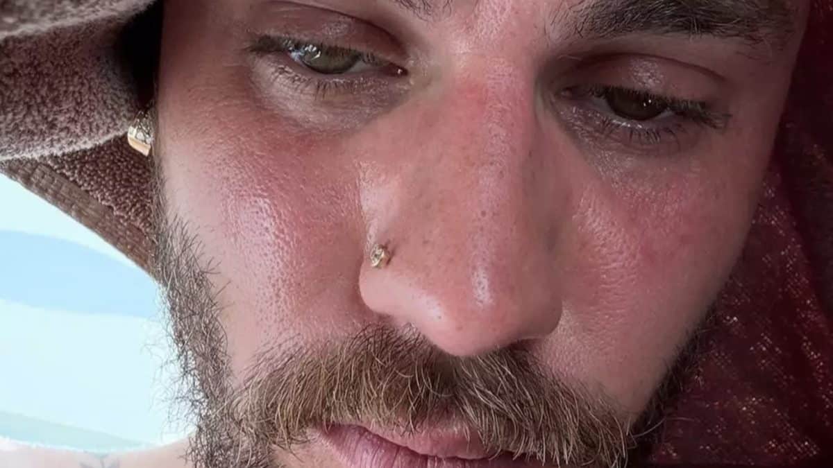 Fãs demonstram preocupação com Justin Bieber após cantor publicar selfie nas redes sociais