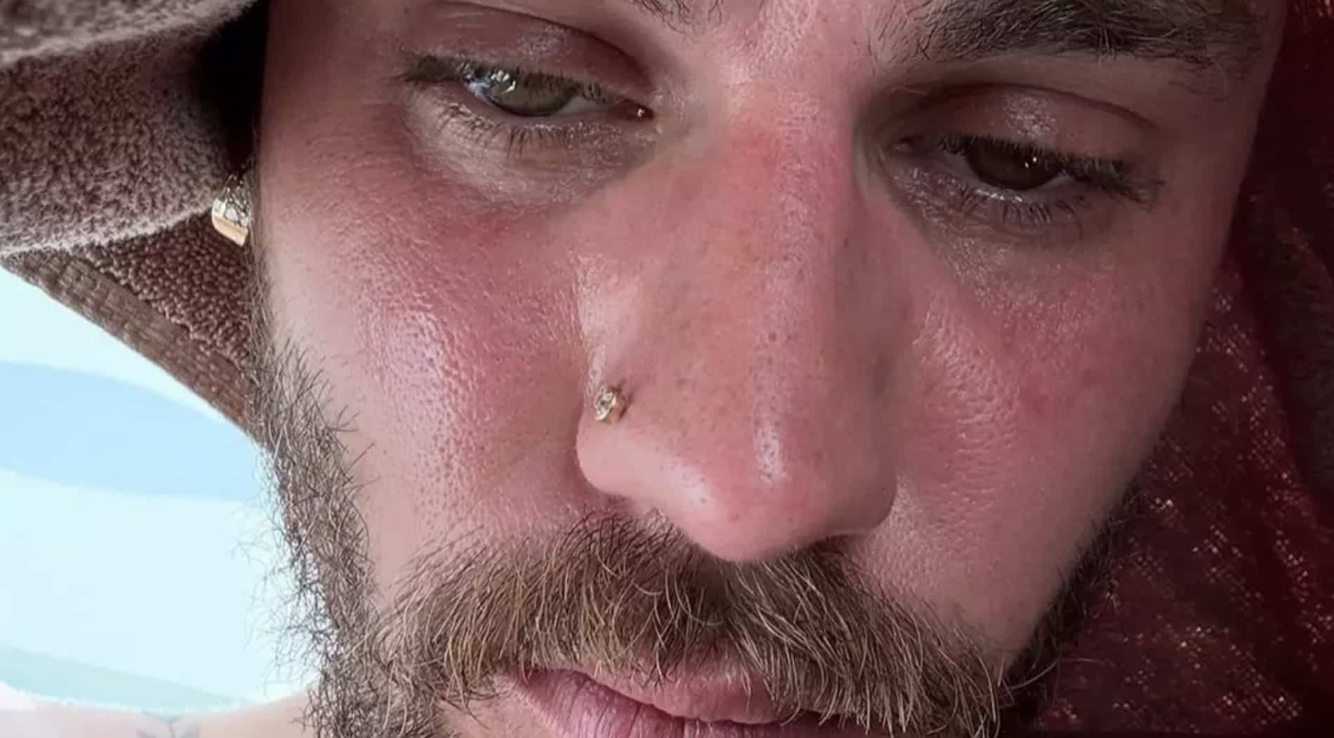 Fãs demonstram preocupação com Justin Bieber após cantor publicar selfie nas redes sociais Fãs demonstram preocupação com Justin Bieber após cantor publicar selfie nas redes sociais