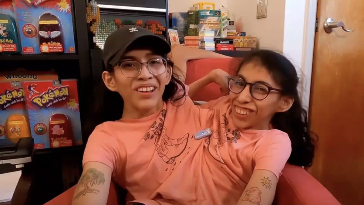 Gêmea siamesa Carmen Andrade anuncia casamento enquanto a irmã Lupita explica por que "não quer se casar"