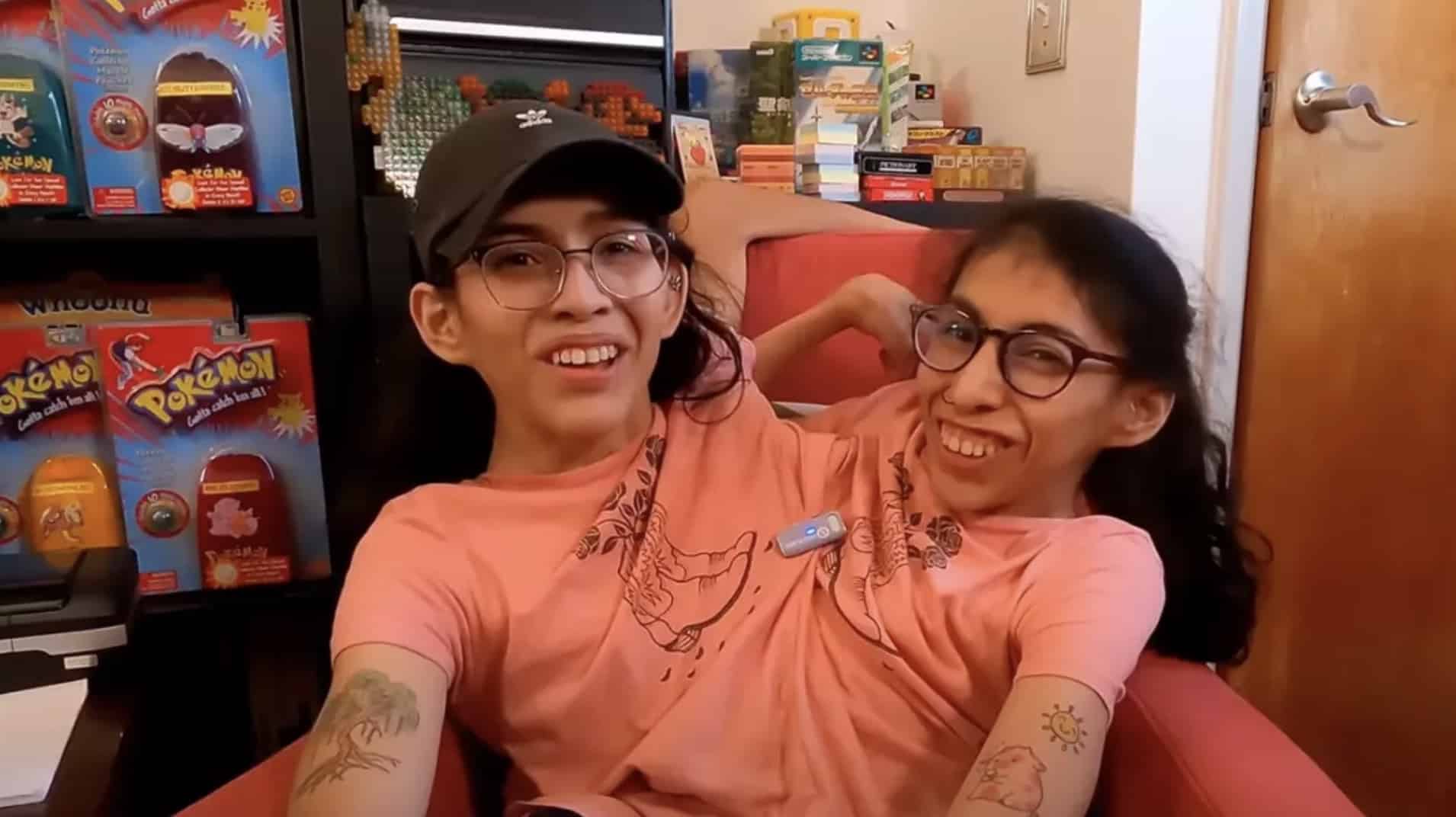 Gêmea siamesa Carmen Andrade anuncia casamento enquanto a irmã Lupita explica por que "não quer se casar" Gêmea siamesa Carmen Andrade anuncia casamento enquanto a irmã Lupita explica por que "não quer se casar"