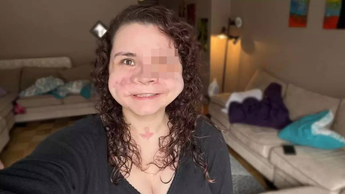 Mulher que recebeu “menos de 2%” de chance de sobrevivência após levar um tiro no rosto compartilha mensagem importante sobre trauma horrível
