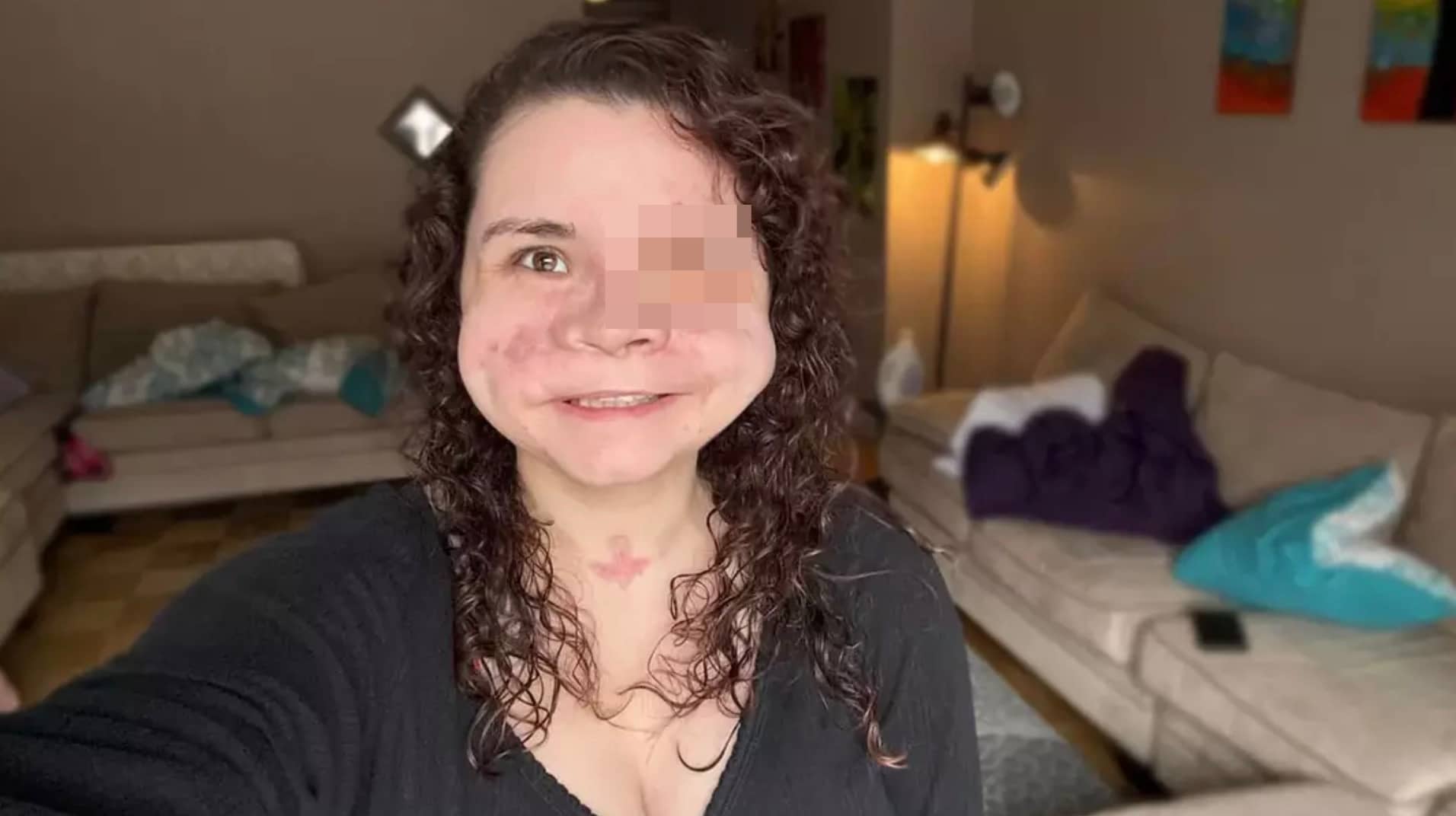 Mulher que recebeu “menos de 2%” de chance de sobrevivência após levar um tiro no rosto compartilha mensagem importante sobre trauma horrível