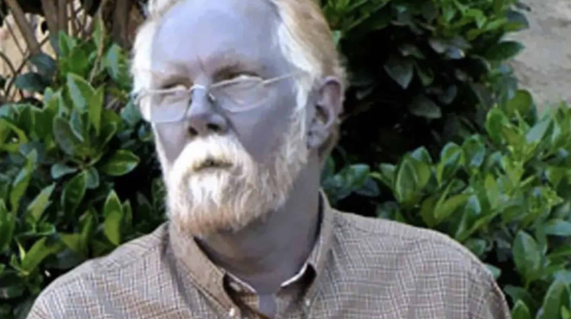 O caso bizarro do homem que sofreu efeito colateral horrível e ficou permanentemente azul O caso bizarro do homem que sofreu efeito colateral horrível e ficou permanentemente azul
