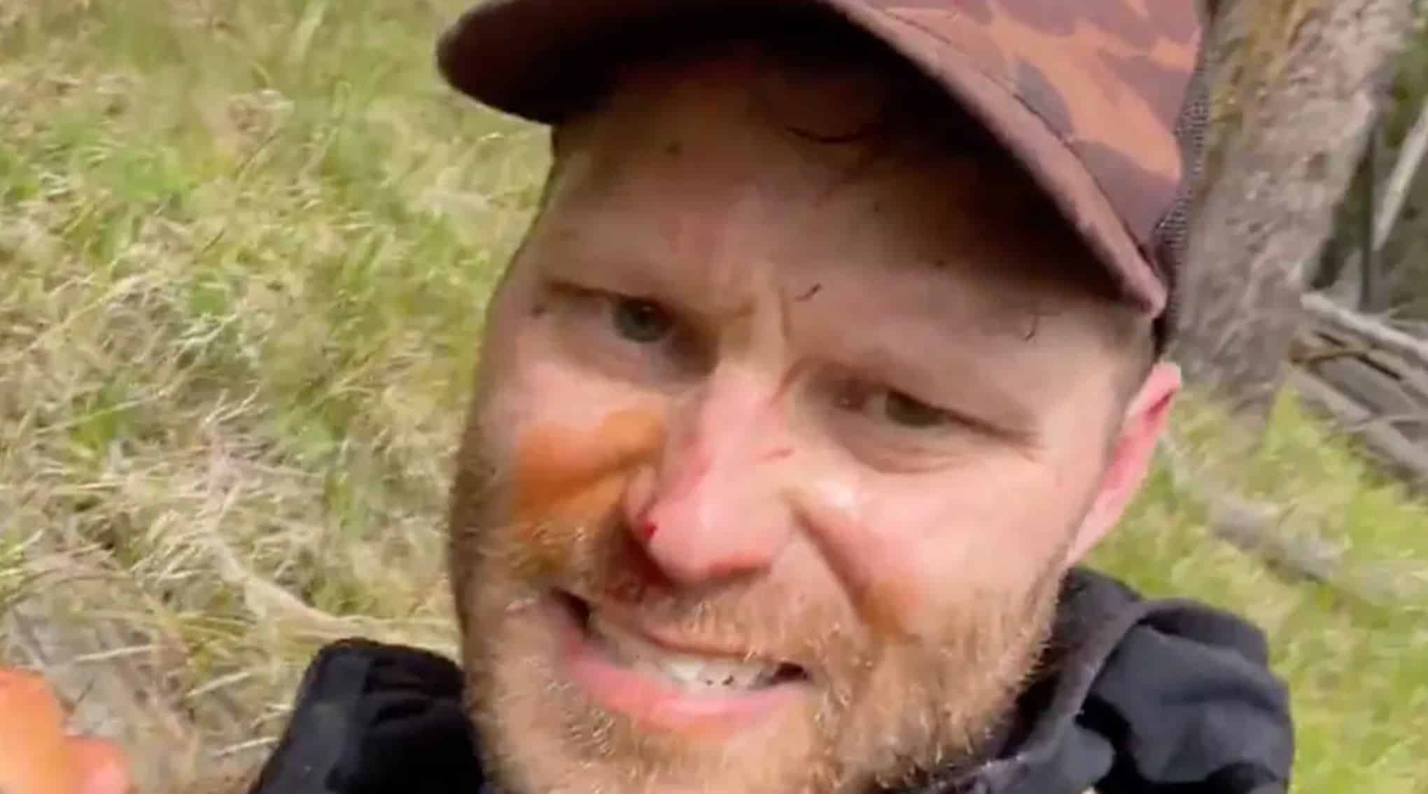 Sobrevivente de ataque de urso gravou mensagem final arrepiante para seus entes queridos após ter o corpo "dilacerado" pelo animal Sobrevivente de ataque de urso gravou mensagem final arrepiante para seus entes queridos após ter o corpo _dilacerado_ pelo animal