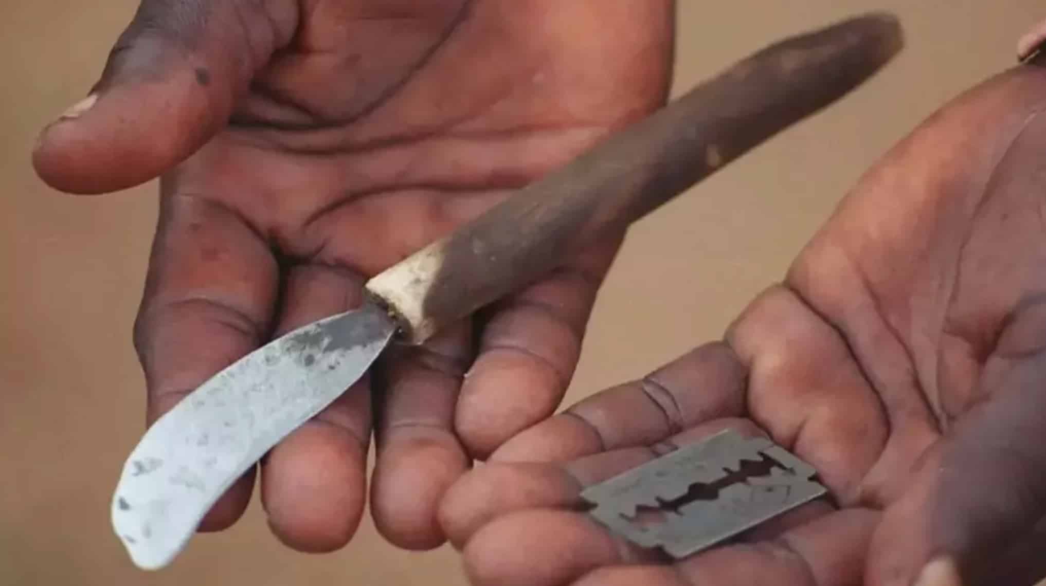 Cerimônia de iniciação com circuncisão em massa deixa 39 meninos mortos Cerimônia de iniciação com circuncisão em massa deixa 39 meninos mortos