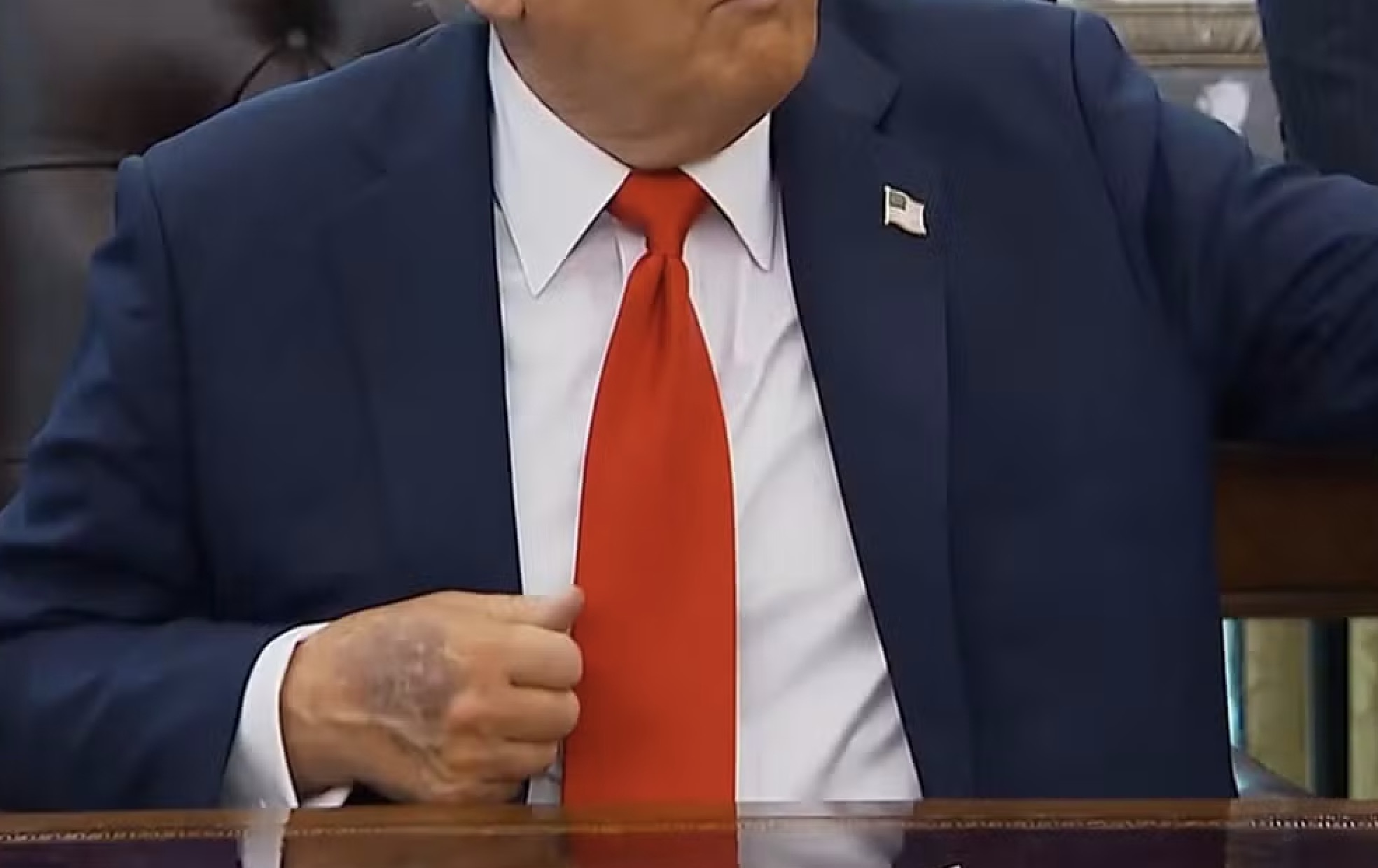 Hematoma na mão de Trump durante evento na Casa Branca em 25 de agosto de 2025