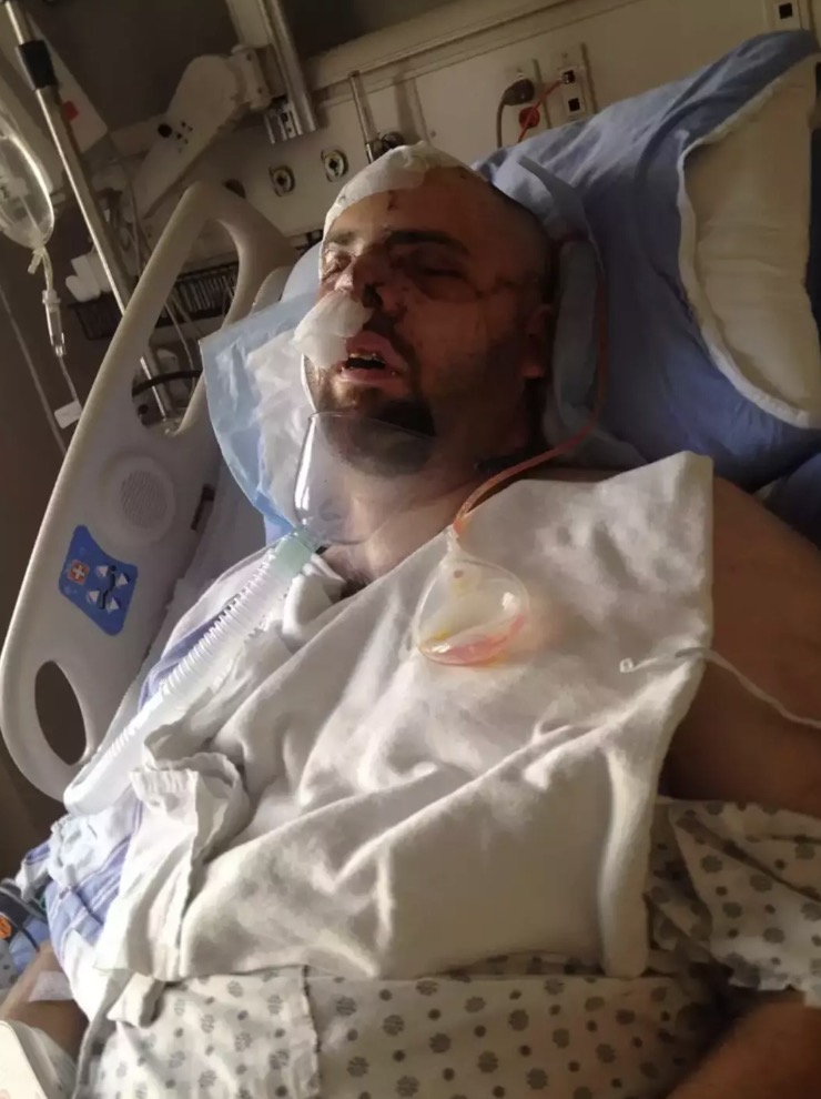 Sobrevivente de ataque de urso escreveu uma nota final arrepiante para seus entes queridos após recolher pedaços da própria carne Jeremy ficou lutando por sua vida