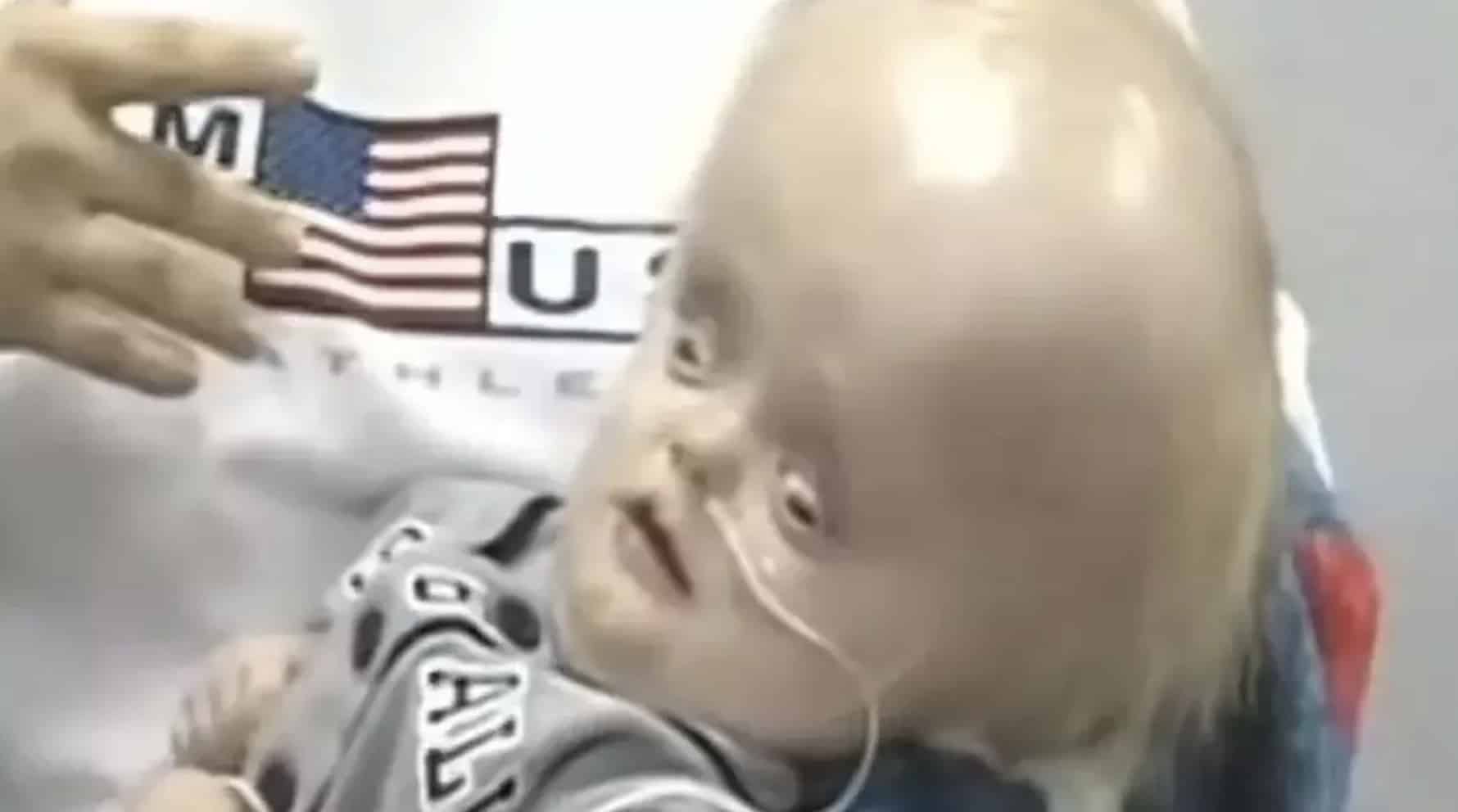 Menino nascido sem cérebro viveu até os 12 anos de idade