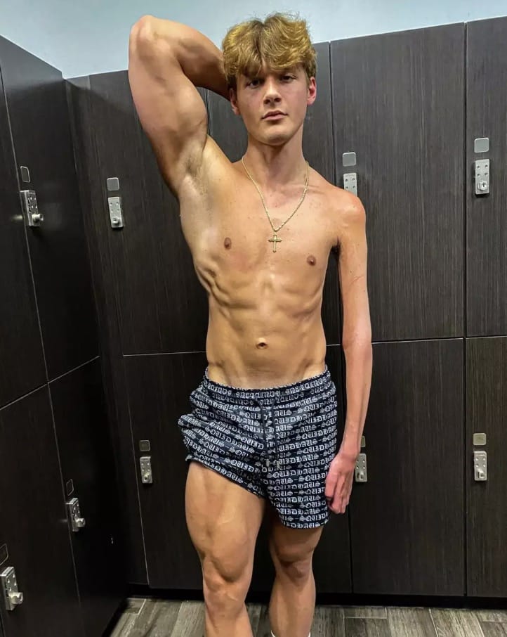 O fisiculturista Jackson Schop só consegue treinar um braço (Instagram/@jacksonschop)