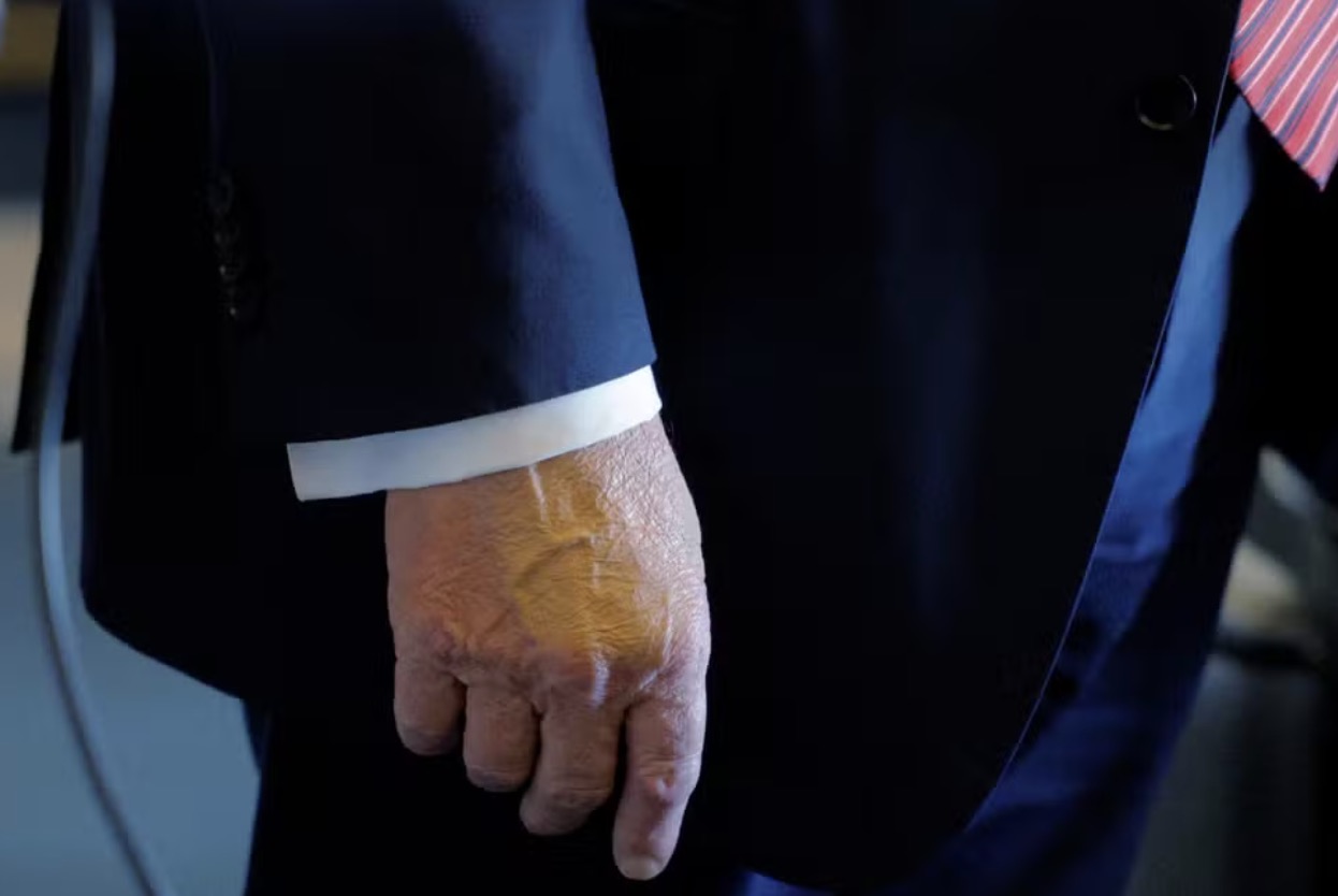 Trump com a mão maquiada em foto do dia 14 de maio