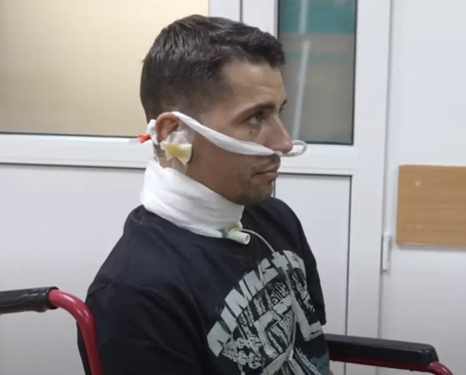 Soldado ucraniano que sobreviveu a tortura e foi "enterrado vivo" conta como conseguiu escapar Um soldado ucraniano sobreviveu milagrosamente à tortura (@SuspilneDnipro/YouTube)
