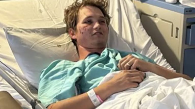 Homem atacado por hienas enquanto dormia em festa de despedida de solteiro sobreviveu graças a essas duas ações