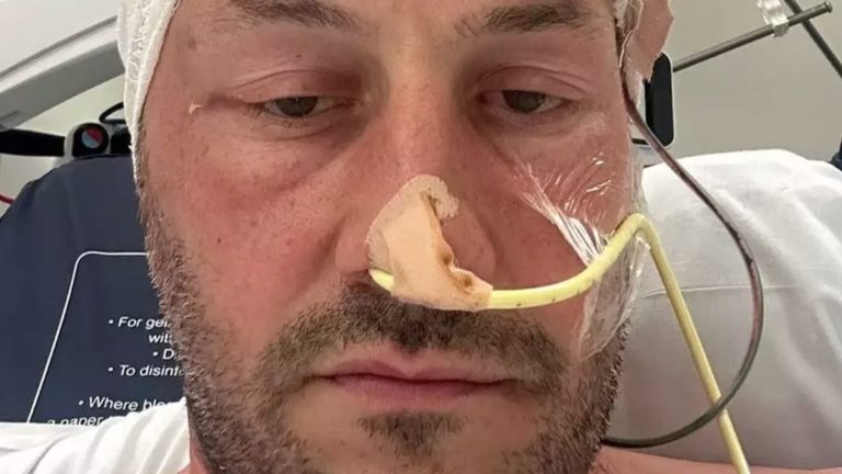 Homem é diagnosticado com dois tumores cerebrais após apresentar sintomas comuns de "ressaca"