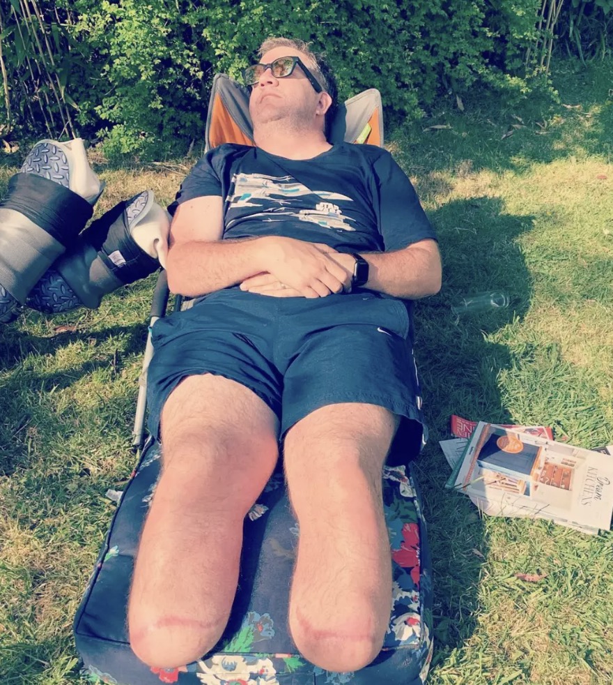 O ex-cirurgião do NHS realizou centenas de amputações em outras pessoas (bionicsurgeon/Instagram)
