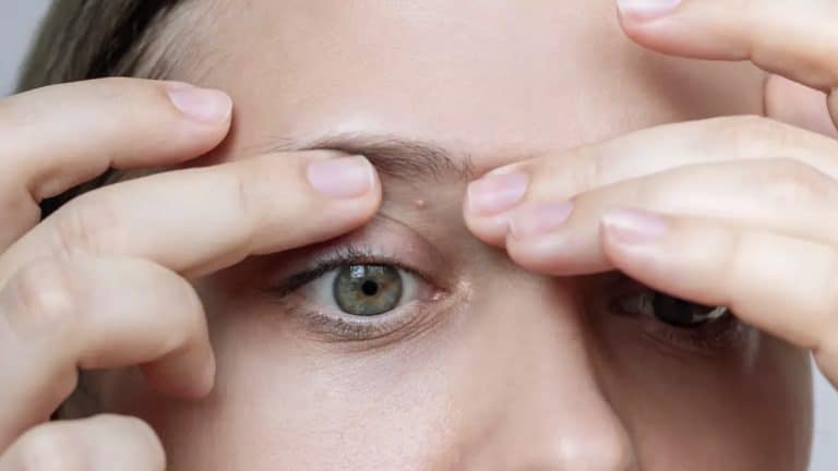 O significado por trás de pequenas manchas brancas que podem aparecer em todo o corpo, inclusive nas partes íntimas