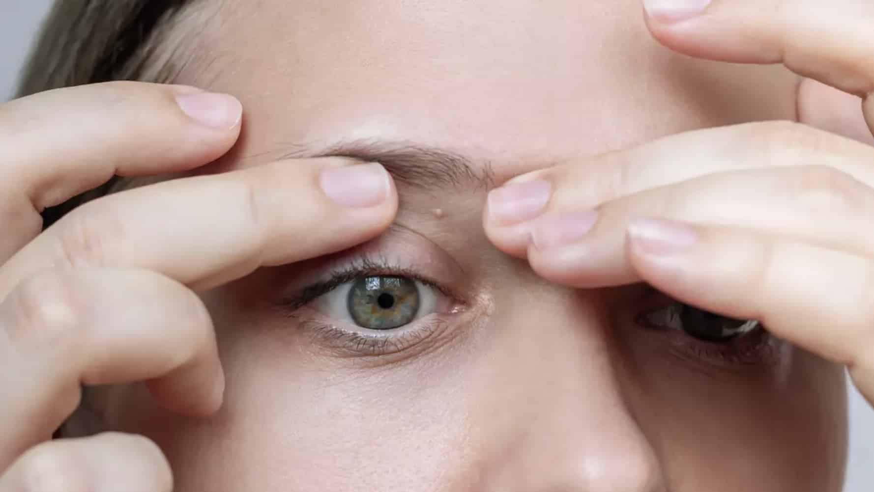 O significado por trás de pequenas bolinhas brancas que podem aparecer em todo o corpo, inclusive nas partes íntimas