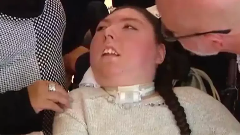 Mulher nascida sem cérebro completa 20 anos enquanto a família descreve o caso como um "milagre"