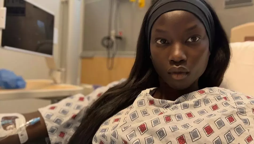 Supermodelo de 28 anos revela um sintoma comum antes de ser diagnosticada com uma condição pulmonar que a deixou “vomitando sangue”