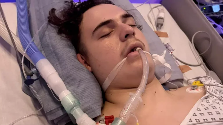 Garoto de 14 anos é diagnosticado com tumor cerebral após médicos garantirem que as enxaquecas "não eram nada preocupante"
