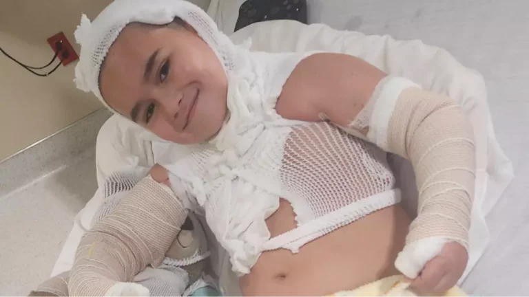Menino de 8 anos achou que "ia morrer" após levar um choque de um carregador de celular na cama