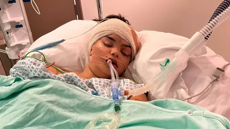 Mulher fica horrorizada ao descobrir por que não parava de esfregar o olho depois de pegar um resfriado