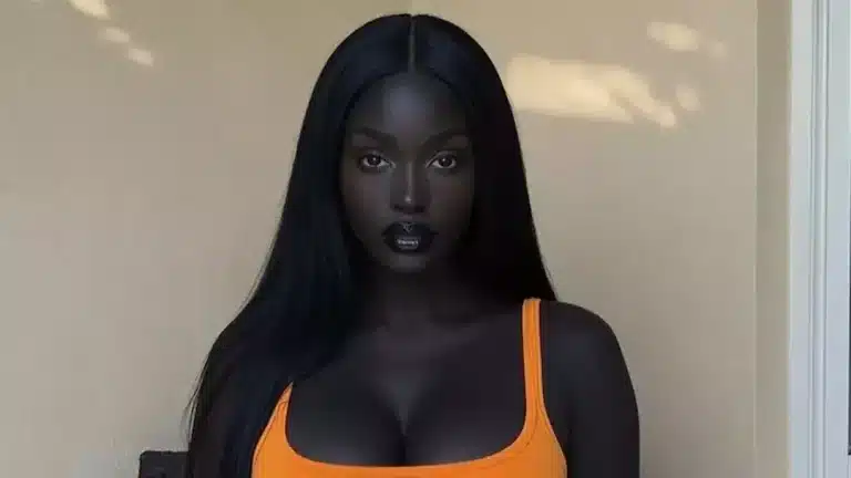 A verdade chocante por trás da influenciadora apelidada de "a garota mais bonita do mundo"
