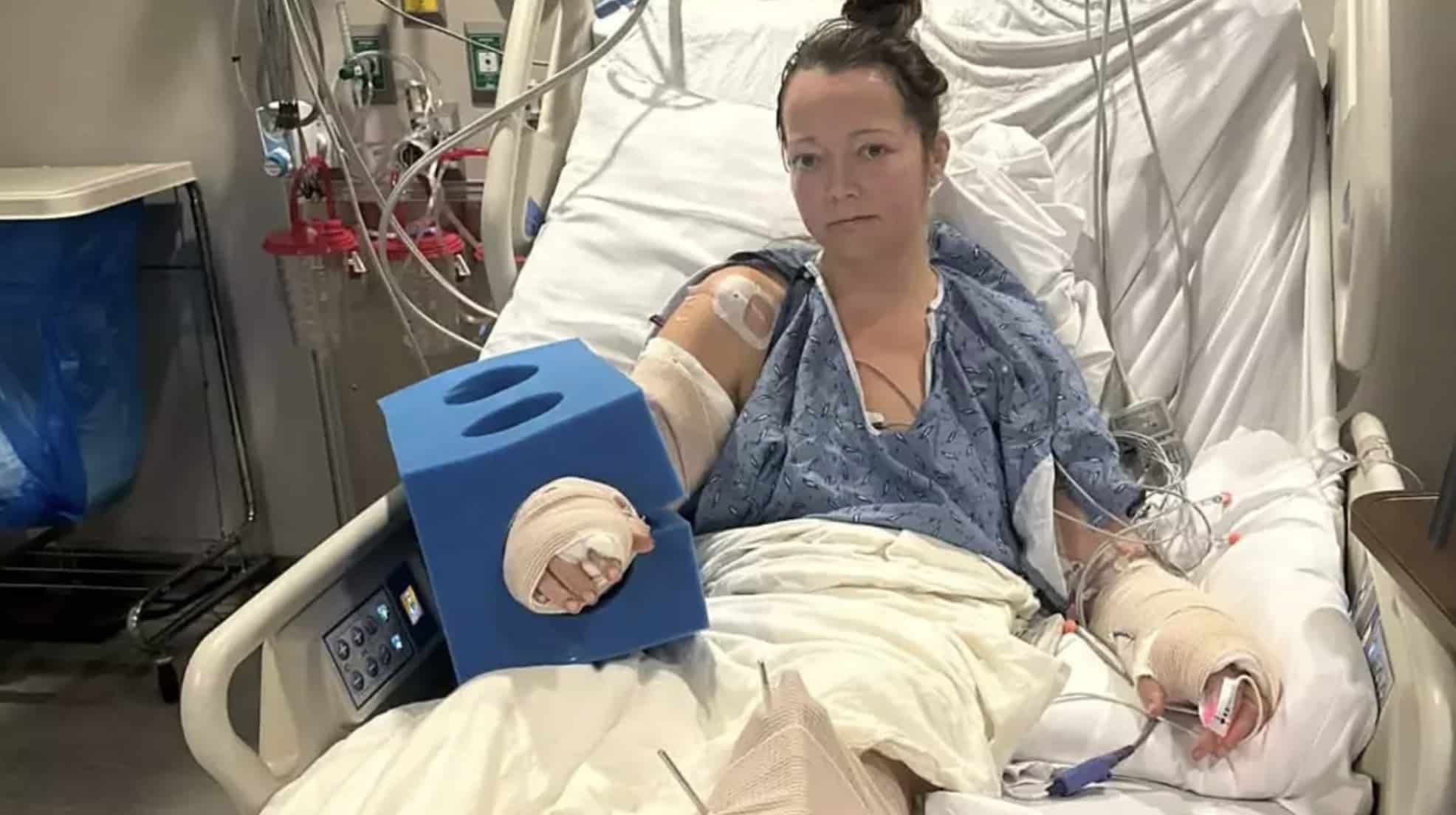 Mãe perde a perna após ataque do próprio pit bull, que deixou o membro “basicamente pendurado”
