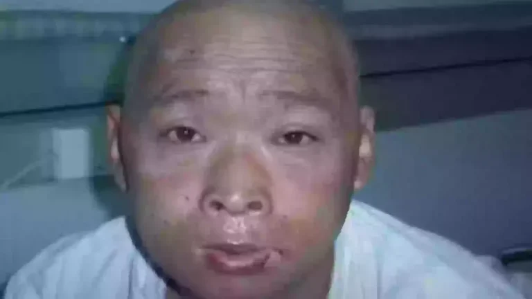 O “homem radioativo” teve apenas um órgão intacto após uma morte agonizante que durou 83 dias