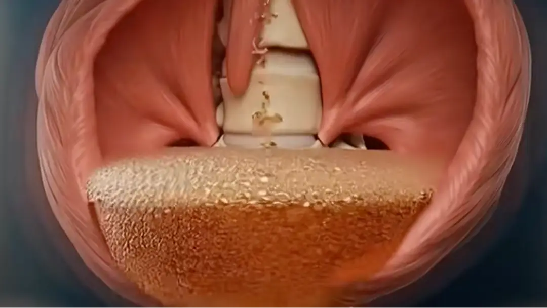 Simulação chocante mostra exatamente o que acontece dentro do seu corpo se você beber refrigerante todos os dias