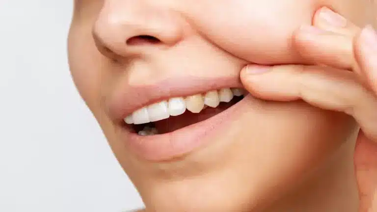 Dentista revela seis erros diários que as pessoas cometem e que deixam os dentes amarelados