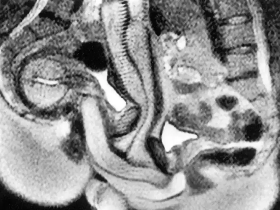 Cientistas queriam saber o que acontece no corpo durante o ato(BMJ)