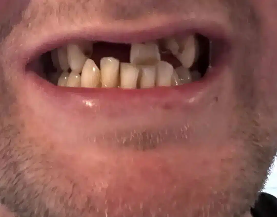 Os dentes do pai começaram a se deteriorar após seu acidente de bicicleta em 2020, o que o levou a viajar para a Turquia para realizar um tratamento dentário (Kennedy News and Media).