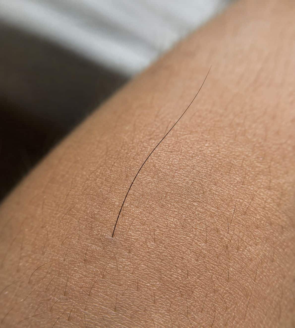 Por que às vezes aparece um pelo longo do nada no braço ou outra parte do corpo?