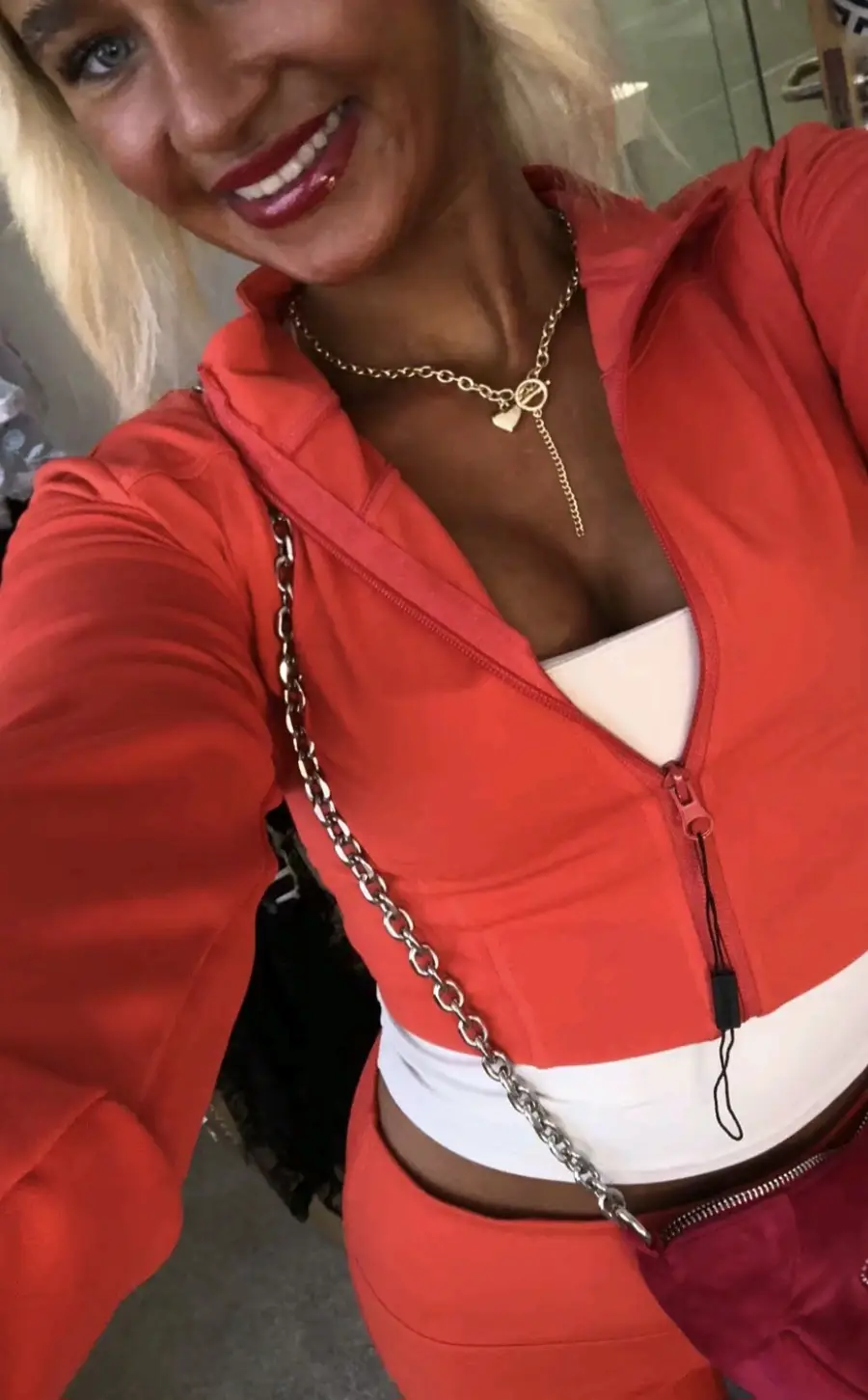 Adolescente viciada em bronzeamento artificial não consegue parar, apesar de pintas que mudam de forma e do risco de câncer Megan usa câmaras de bronzeamento desde os 16 anos