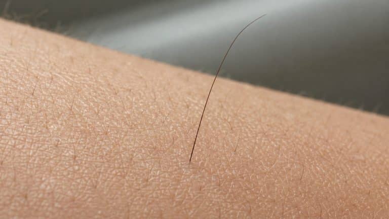 Por que às vezes aparece um pelo longo do nada no braço ou outra parte do corpo?