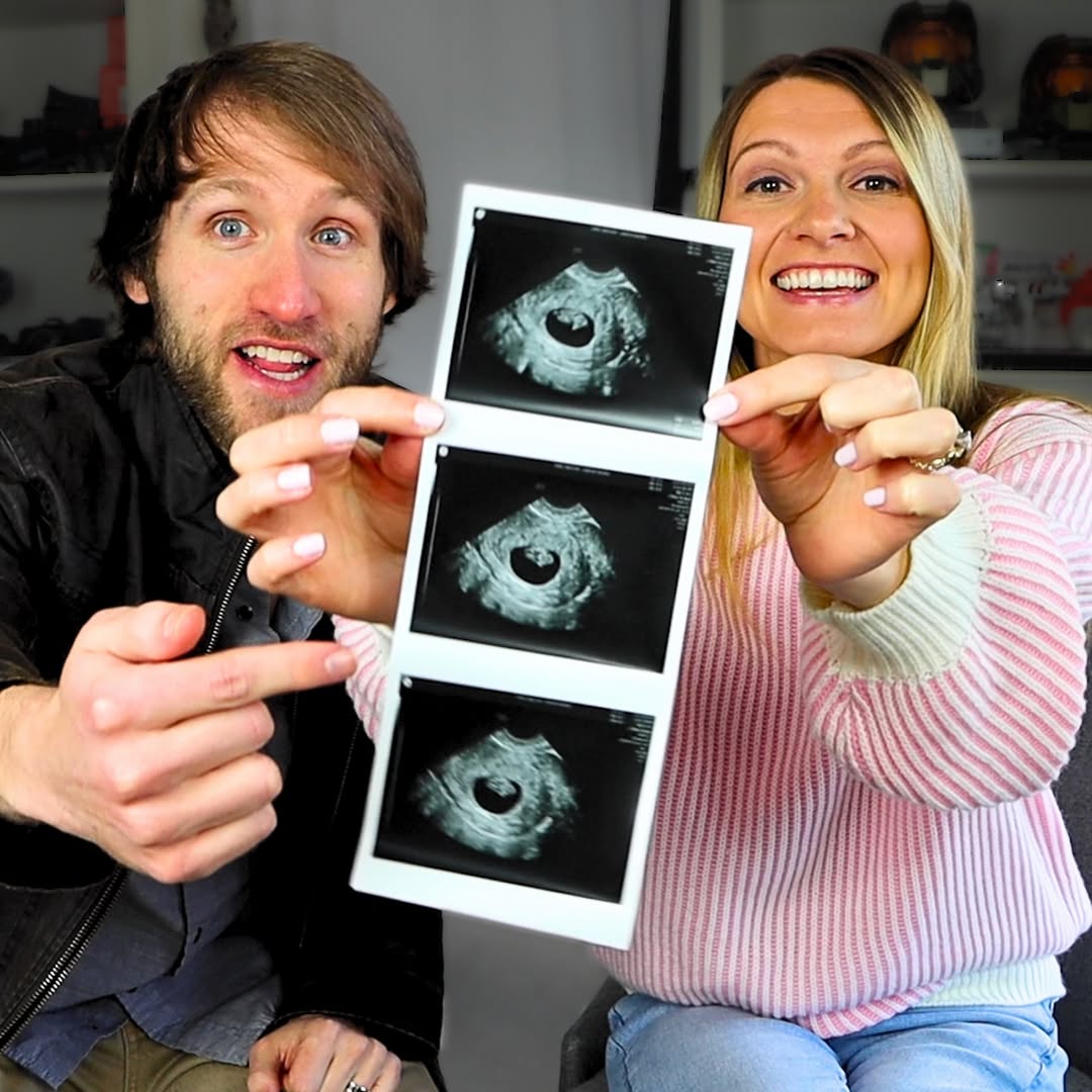 Casal de youtubers que decidiu interromper a gravidez após um diagnóstico de síndrome de Down responde às críticas recebidas