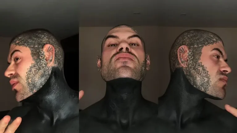 Homem com tatuagens blackout revela o que gostaria de ter sabido antes de iniciar o processo
